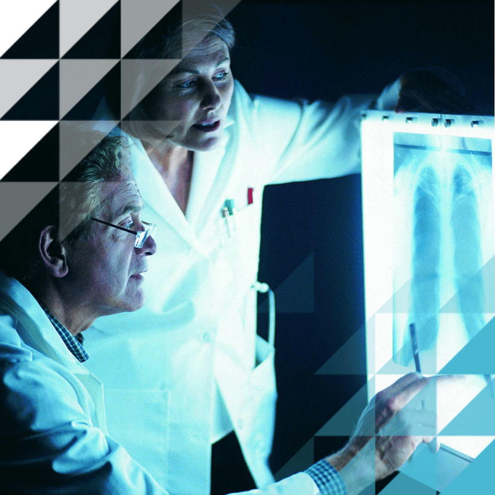 Un medico anziano con gli occhiali e un collega in camice bianco esaminano una radiografia del torace tenuta controluce in un ambiente clinico.